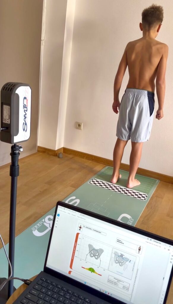 Komputerowa ocena postawy ciała 3D systemem SAM 3D LITE w Alpina Body Lab