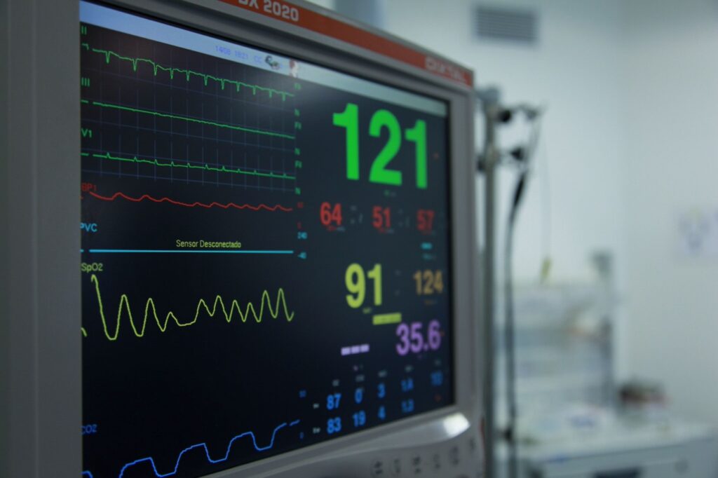 Monitor z zapisem pracy serca – diagnostyka EKG